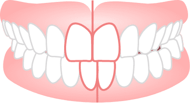 中心がずれている